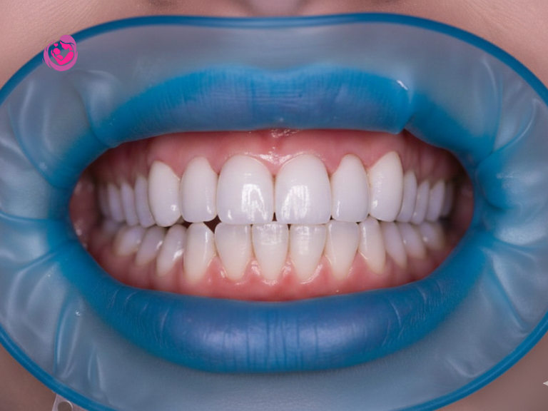 ceramic teeth cap