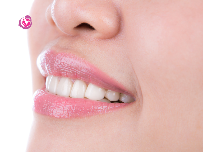 white spots on teeth